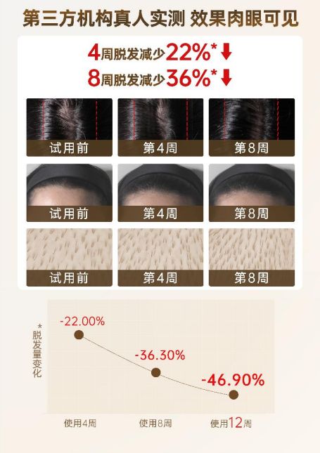 日本TikTok人气第一胖东来卖断货的防脱礼盒专治“秃”然焦虑(图7)